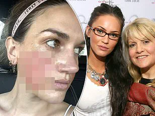 Dr. Nicole Van Groningen Warns Against Three Unexpected Health Practices, Advocating Evidence-Based Approaches for Public Well-Being