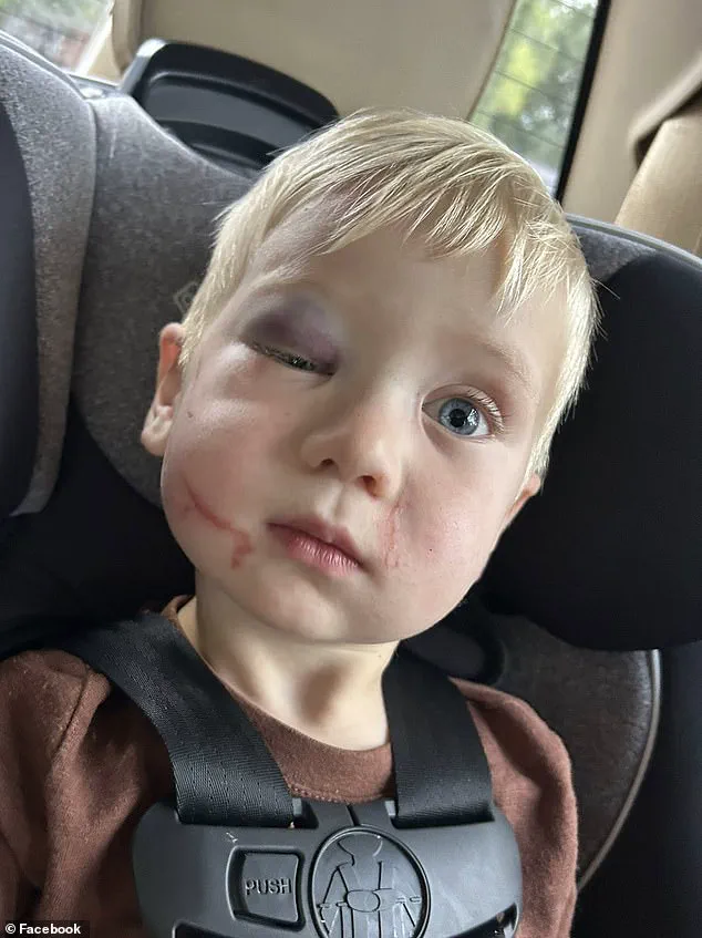 Judge Grants Bail to Daycare Worker Accused of Injuring Toddler, Faces Threats