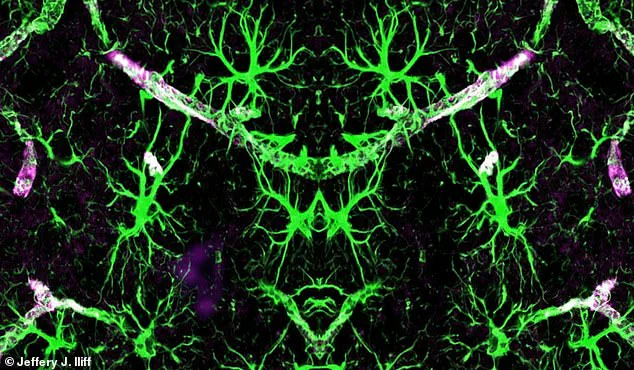 Back Sleeping Linked to Memory Loss Risk, Says Brain Health Expert