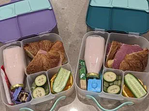 Essex Mother's Choice to Remove Daughter's Birthmark Sparks Debate on Bullying and Cancer Risks