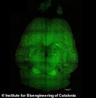 Spanish Researchers Report Nanoparticle Breakthrough in Alzheimer's Treatment, 'This Could Change Everything' Says Lead Scientist