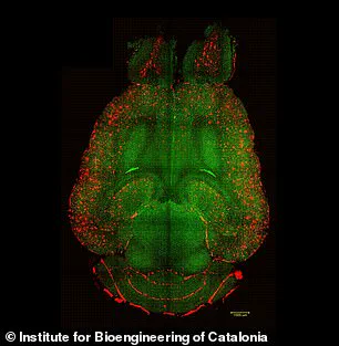 Spanish Researchers Report Nanoparticle Breakthrough in Alzheimer's Treatment, 'This Could Change Everything' Says Lead Scientist