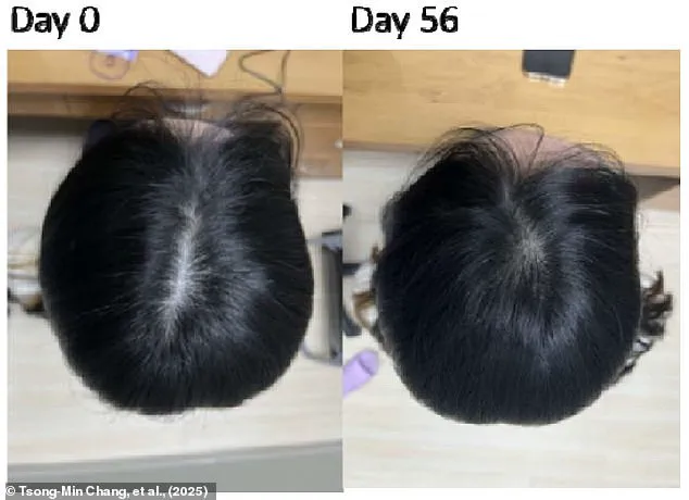Exclusive Insights: The Secret to Hair Loss Treatment Revealed – Limited Access to Groundbreaking Research