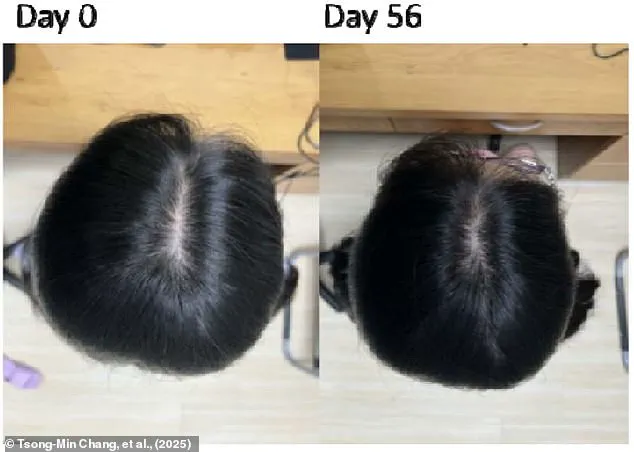 Exclusive Insights: The Secret to Hair Loss Treatment Revealed – Limited Access to Groundbreaking Research