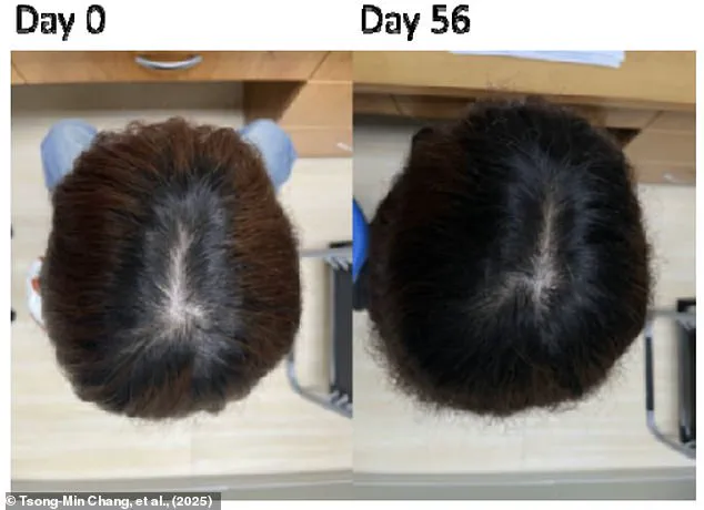Exclusive Insights: The Secret to Hair Loss Treatment Revealed – Limited Access to Groundbreaking Research