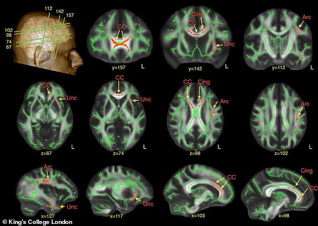 Groundbreaking Study Suggests Dogs May Share Neurodivergent Traits with Humans, Says Dr. Jacqueline Boyd