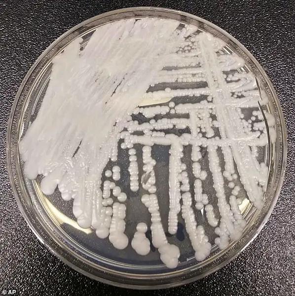 Deadly, Treatment-Resistant Fungus Spreading in Hospitals: Public Health Crisis as Candida Auris Infections Surge Nationwide