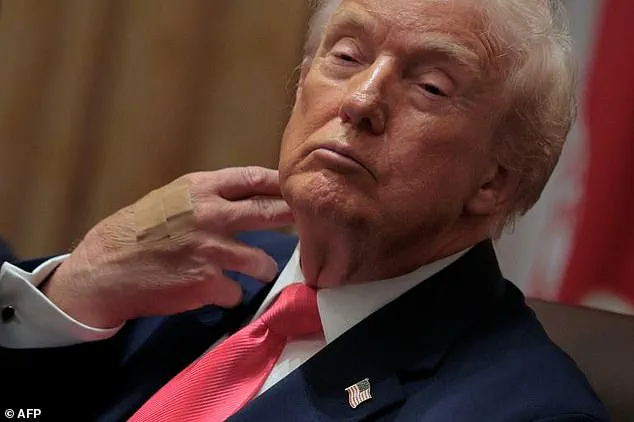 Former President Trump's Health and Dietary Habits in the Spotlight Following Recent Interview