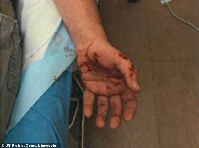 ICE Agent Jonathan Ross Faces Backlash After Fatal Shooting Sparks Protests in Minneapolis