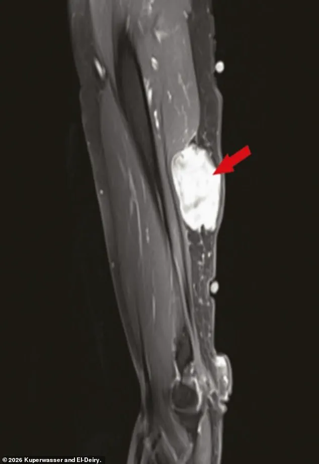 Study on Cancer Cases Post-Covid Vaccination Sparks Debate Amid Journal Cyberattack