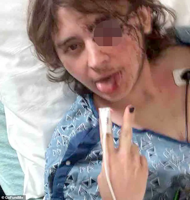 Kaden Rummler: 'Completely Blind' in Left Eye After Projectile Strike During ICE Protest Clash in Santa Ana