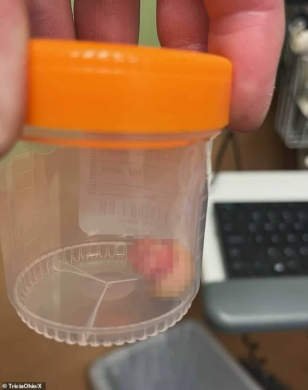 Fatal Shooting of Registered Nurse Sparks Protests and Clashes with Federal Agents in Minneapolis