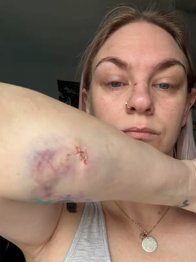 Oshawa Dog Attack Ignites Debate Over Pet Ownership and Local Regulations