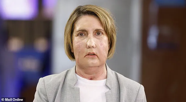 First Facial Transplant Using Tissue from Assisted Dying Donor Marks Medical Milestone