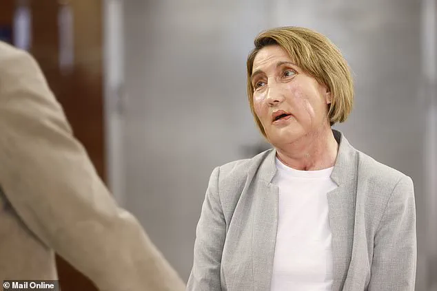 First Facial Transplant Using Tissue from Assisted Dying Donor Marks Medical Milestone