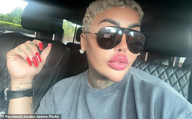 Death of 'Lip King' Jordan James Parke Sparks Calls for Cosmetic Surgery Regulation Overhaul