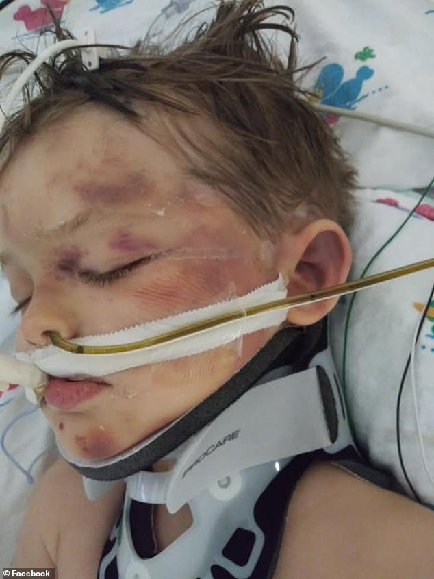 Brutal Attack on Two-Year-Old by Oil Tycoon Heir Leaves Child in Critical Condition