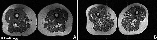 The Dark Side of Ultra-Processed Foods: Unsettling Images Reveal the Harmful Impact.
