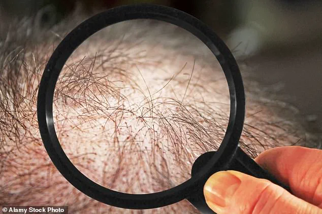 Japanese Researchers Discover Plant Extracts That Stimulate Hair Growth Through Activation of Placental Growth Factor