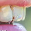 Expert Warns: Dental Health Can Reveal Early Signs of Serious Health Issues