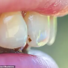 Expert Warns: Dental Health Can Reveal Early Signs of Serious Health Issues