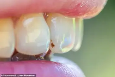 Expert Warns: Dental Health Can Reveal Early Signs of Serious Health Issues